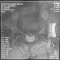 MRI Dwars Slice 8 9