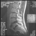 MRI Lengte Slice 3 11