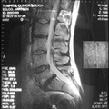 MRI Lengte Slice 5 11