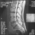 MRI Lengte Slice 7 11